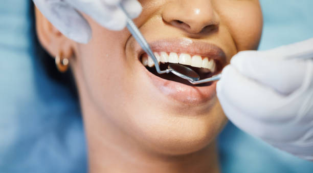 Best Emergency Root Canal Treatment in Vevay, IN