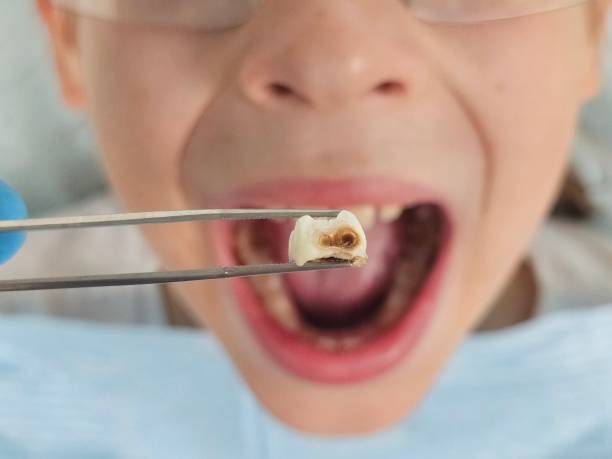 Best Emergency Denture Repair in Vevay, IN